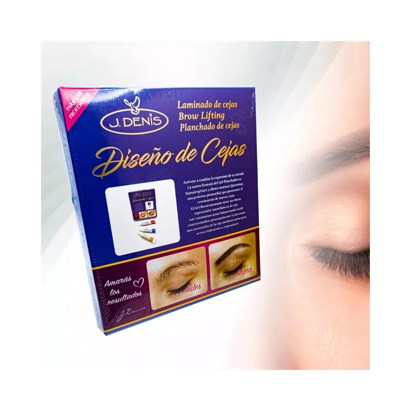 ibspot-36056005